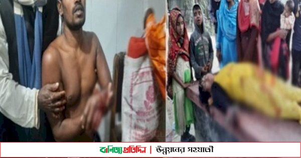 ভূঞাপুরে ৪ ভোটারের কব্জি ও আঙ্গুল কেটে নিলো প্রতিপক্ষ