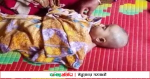 সাপের দংশনে কন্যার মৃত্যু, বাবা হাসপাতালে ভর্তি