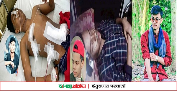 ফরিদগঞ্জে প্রবাসীর ছুরিকাঘাতে দুই তরুণ আহত